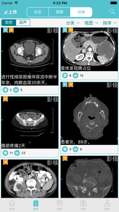 影领ios版 V3.1.0